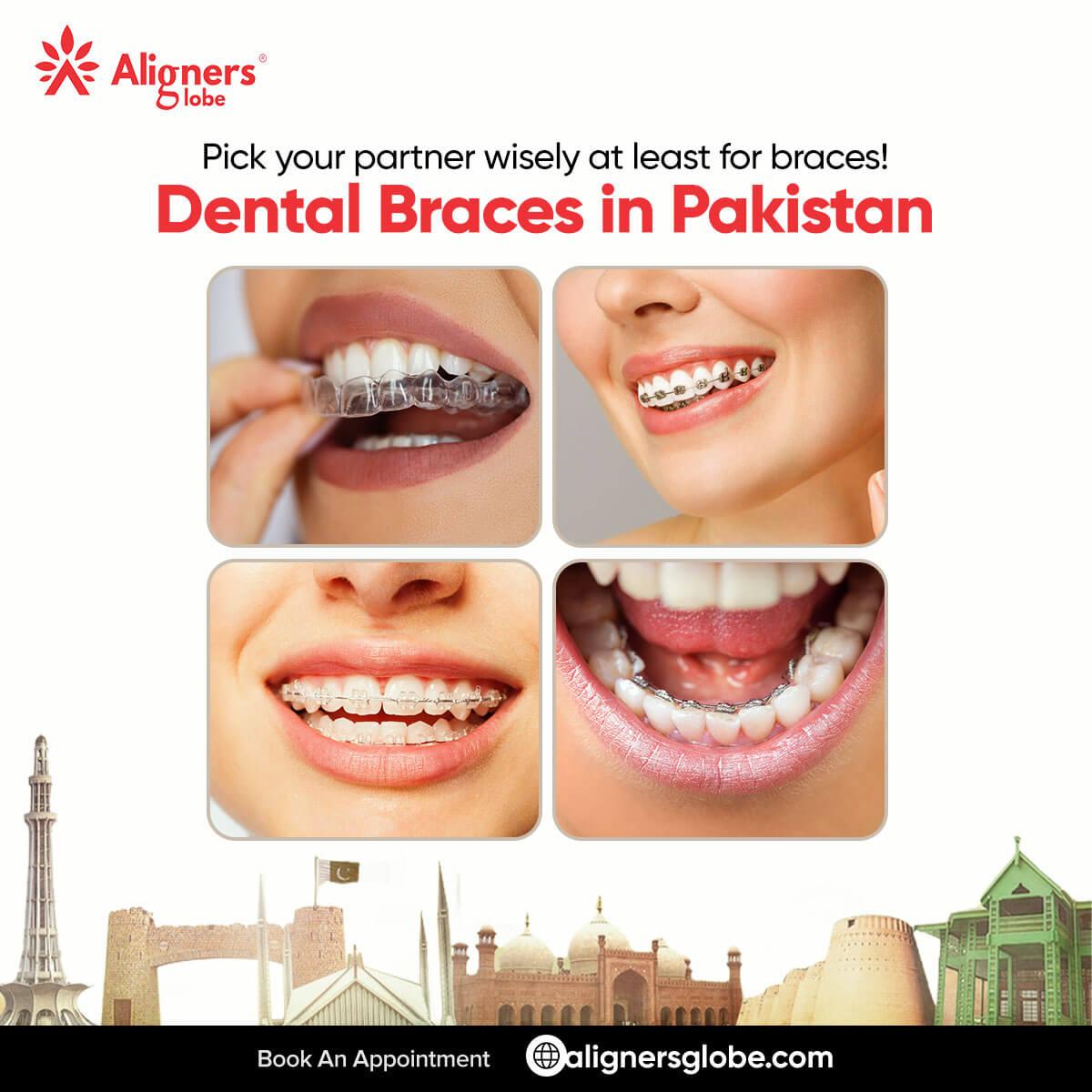 Teeth braces price in Pakistan